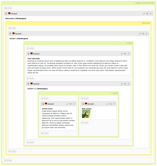 Beispiel für ein Rasterelement im Akkordeon, Ansicht im Backend.